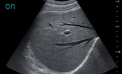 Технология MicroScan